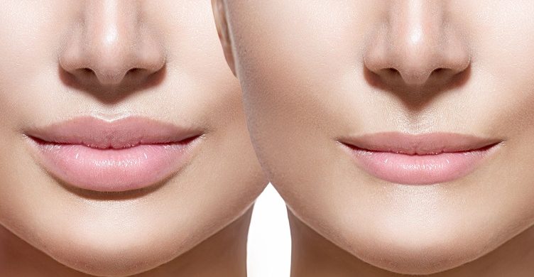 How to get smaller lips